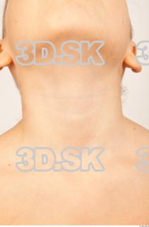 Neck texture of Lon 0001